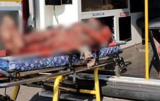 Ataca manada de perros a indigentes en calles de Ixtapaluca