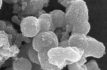 Analiza universidad tratar el Parkinson con nanotecnología
