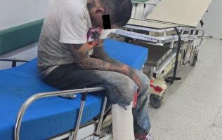 Golpean a fémina bajo sustanciales ilegales