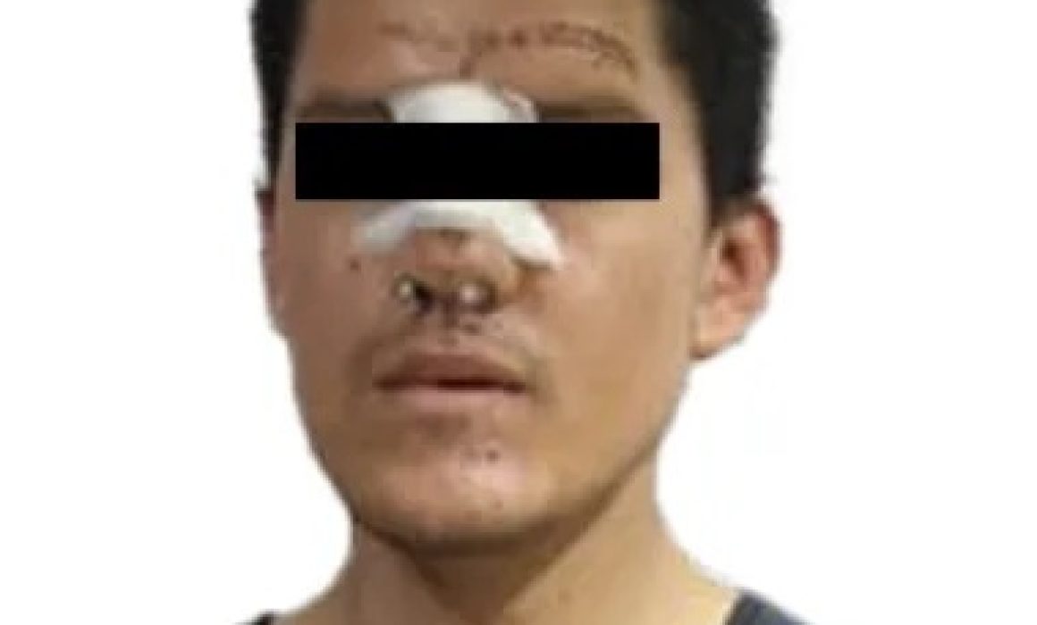 Capturan a masculino por intentar prenderle fuego a su pareja