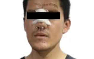 Capturan a masculino por intentar prenderle fuego a su pareja