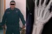 Acusan al padre del director de Seguridad de Chiconcuac de disparar contra joven