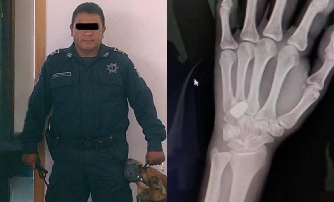 Acusan al padre del director de Seguridad de Chiconcuac de disparar contra joven