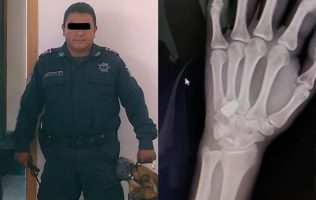 Acusan al padre del director de Seguridad de Chiconcuac de disparar contra joven