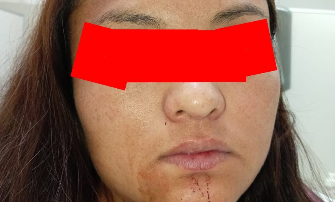 Exigen justicia para Blanca N., agredida y sin atención en Amecameca