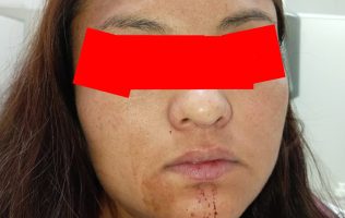 Exigen justicia para Blanca N., agredida y sin atención en Amecameca