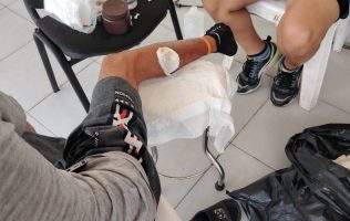 Migrante cubano infectado con miasis solicita ayuda a Sheinbaum