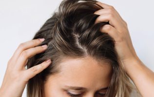 Causa estrés navideño caída de cabello
