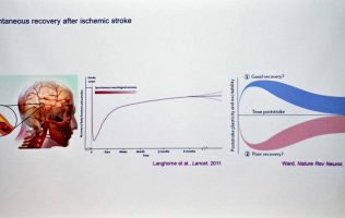 Analiza comunidad biomédica mecanismos cerebrales tras infarto