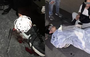Choque entre motociclistas deja 2 heridos graves en Las Américas, Ecatepec