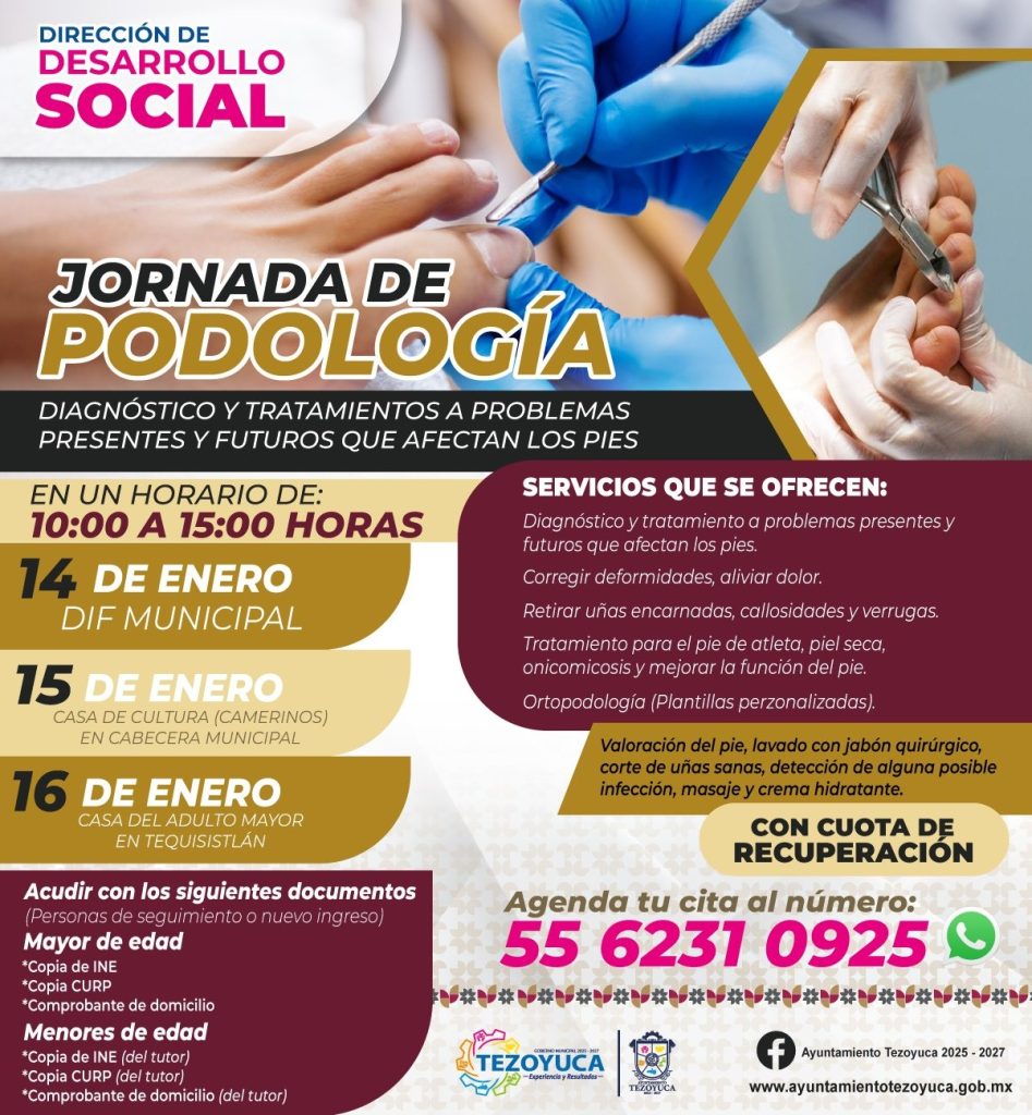 FOTO: Tezoyuca