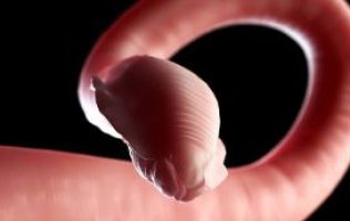Refuerzan alerta sanitaria por parásitos intestinales en México