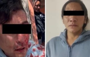 Salvan a bebé brutalmente golpeado; padres detenidos en Ecatepec