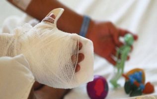 Implementa Edomex Código Quemados para salvar vidas mediante atención