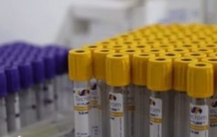 Tiene Tianguistenco el laboratorio más económico de Edomex