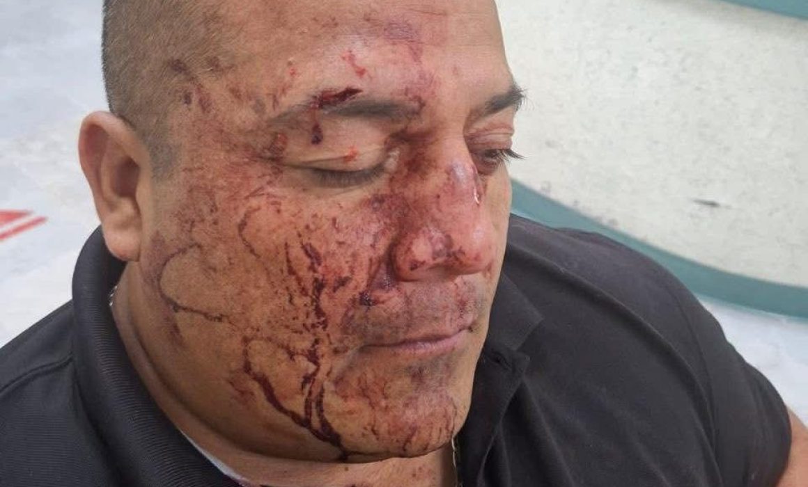 Agreden civiles a policías municipales en Metepec; hay 5 detenidos