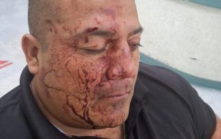 Agreden civiles a policías municipales en Metepec; hay 5 detenidos