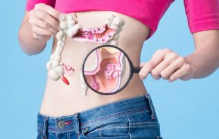 Busca Edomex frenar cáncer de colon; 60% se detecta en etapa avanzada