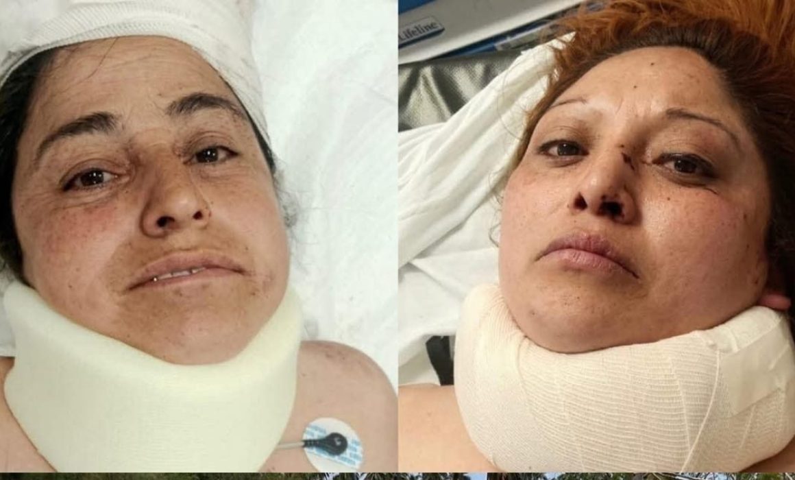 Buscan a familiares de mexiquenses accidentados en Acapulco