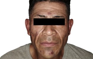 Capturan a presunto homicida de estudiante de FES Cuautitlán